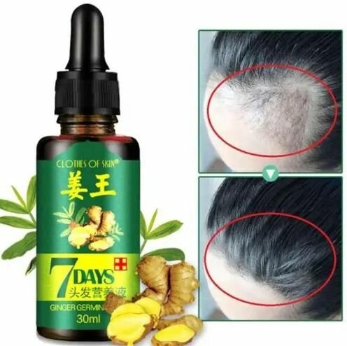 7 Days Ginger Hair Growth Oil Serum For Damaged 30ML Ac3058