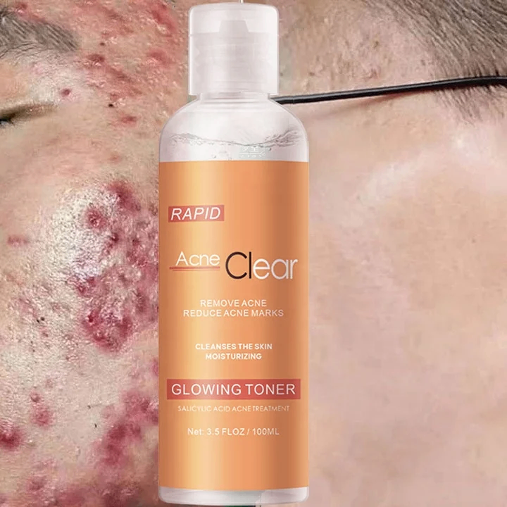 Toner Anti-Acné Rapid