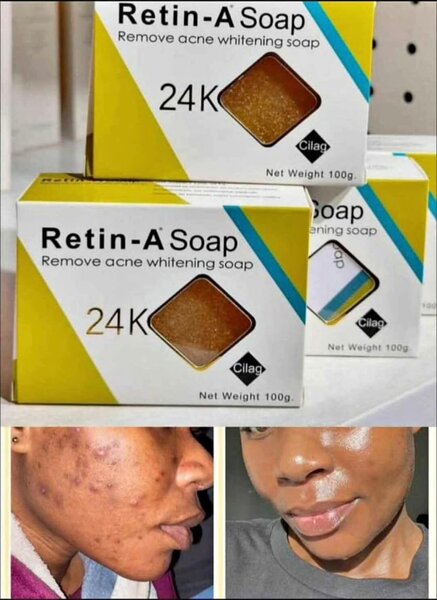 Savon Retin-A Anti-Acné 24K