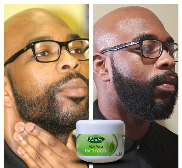 Rhabs Aloe Vera Beard & Hair Growth Food