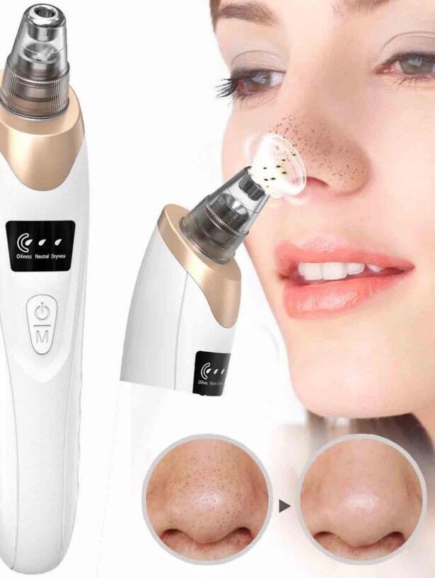 Appareil anti graisse