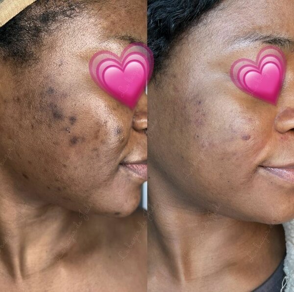 1 Savon exfoliant naturel