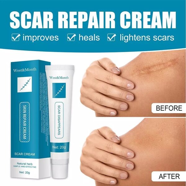 Skin repair gel