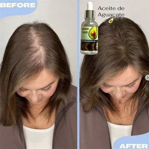 Sérum pour les cheveux