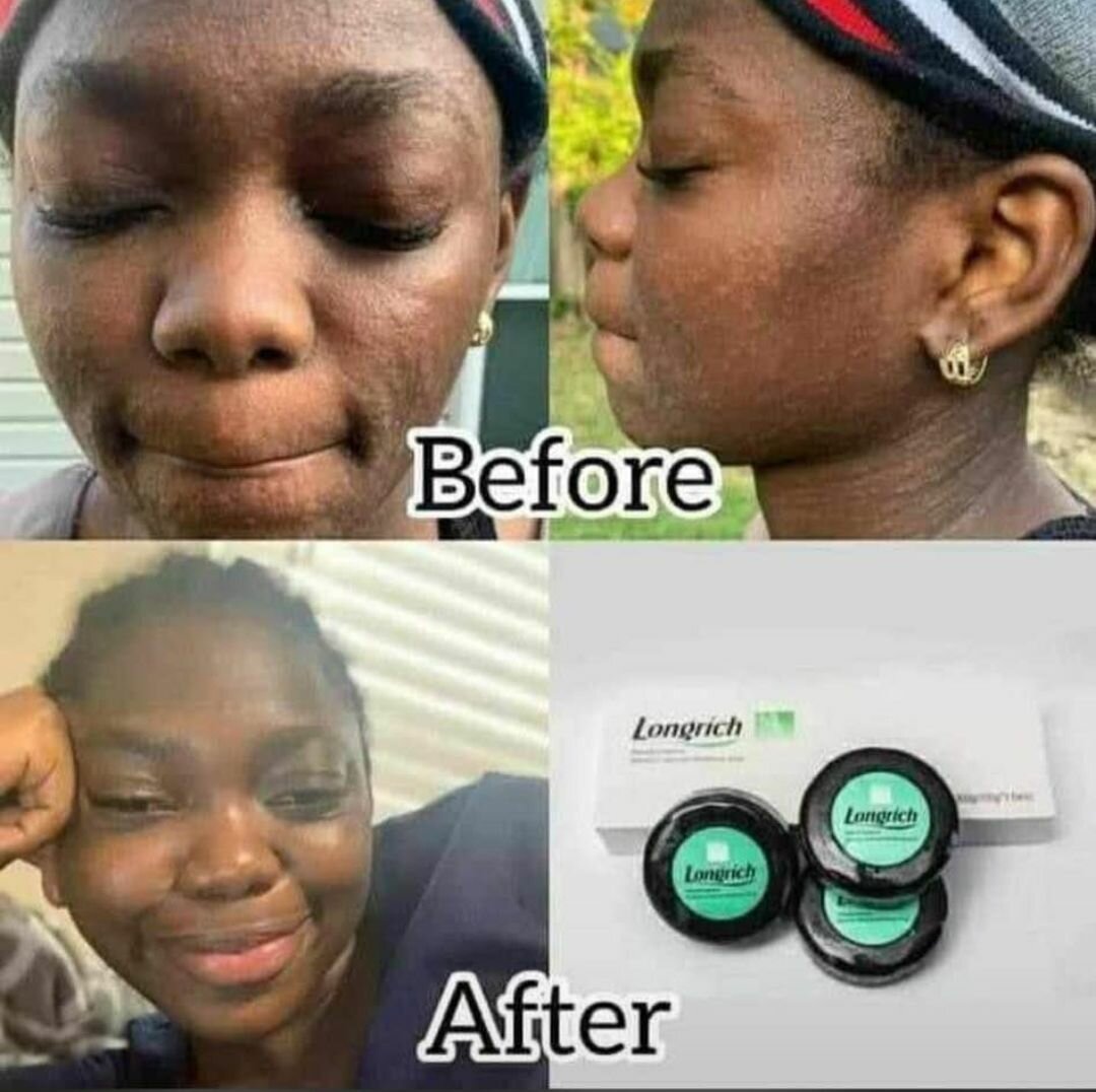 Longrich products
