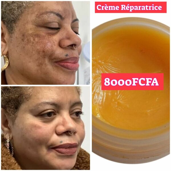Crème Réparatrice Anti-Taches