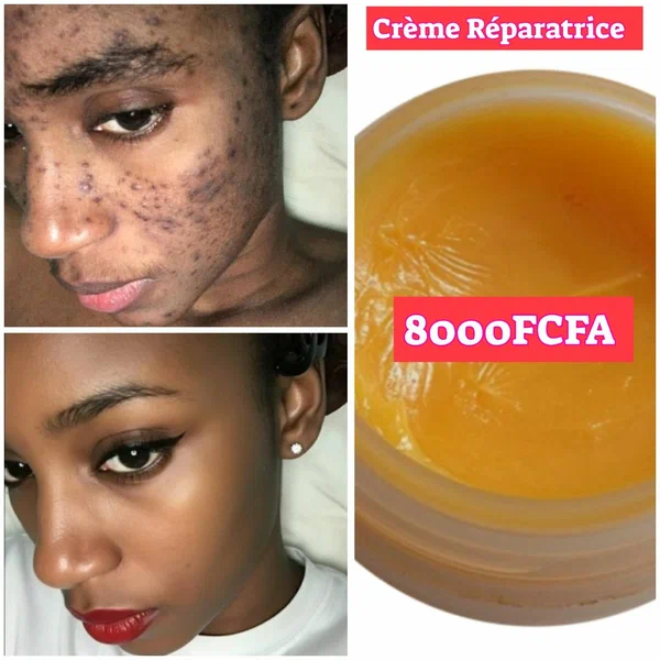 Crème réparatrice Anti-Taches