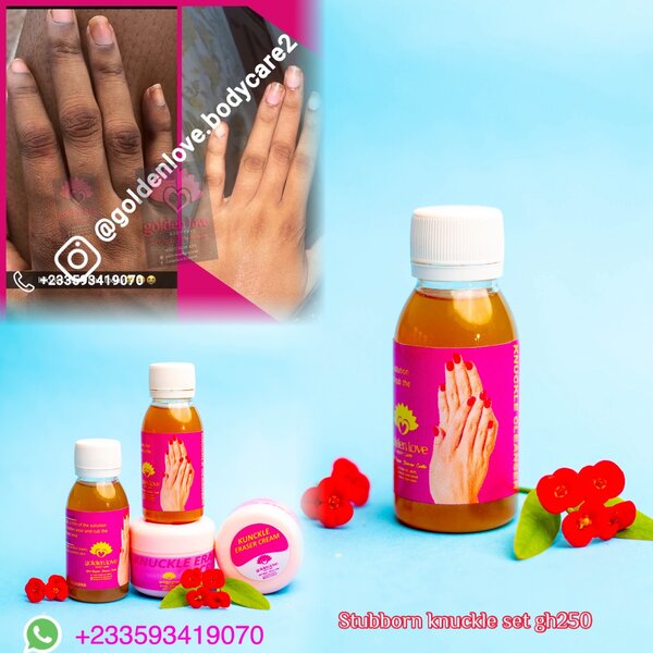 Stubborn knuckle set