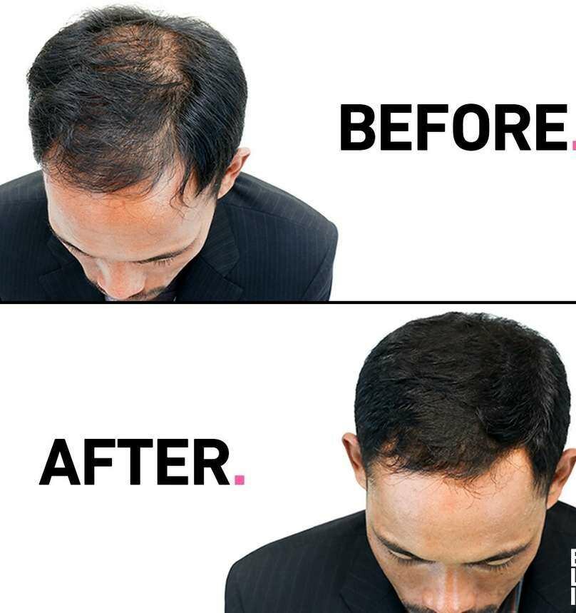 Toppik Fibres Capillaires Noires