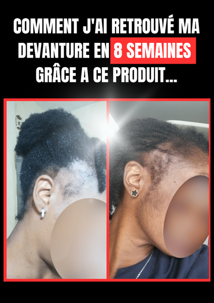 Kirkland Minoxidil Solution