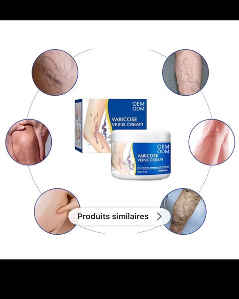 Crème Varices Soulagement