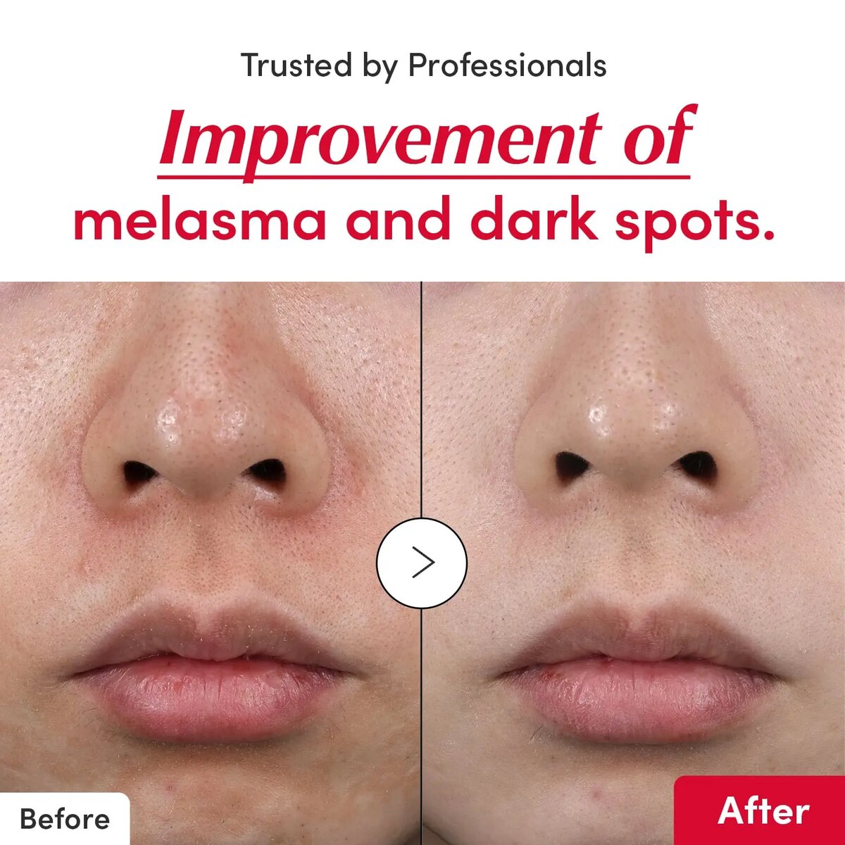 Eqqualberry Vitamin Serum