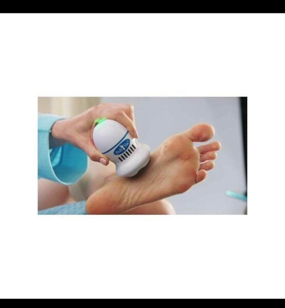 Enlevez les callosités en quelques secondes! Retrouvez enfin