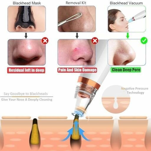 Acne Pimple Pore Vacuum