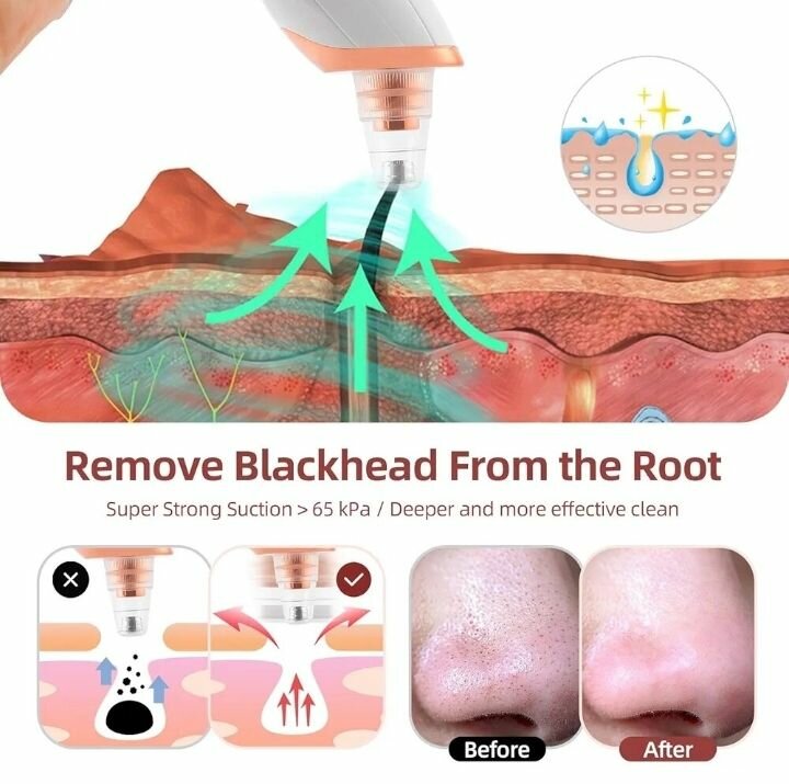 Aspirateur Points Noirs Électrique