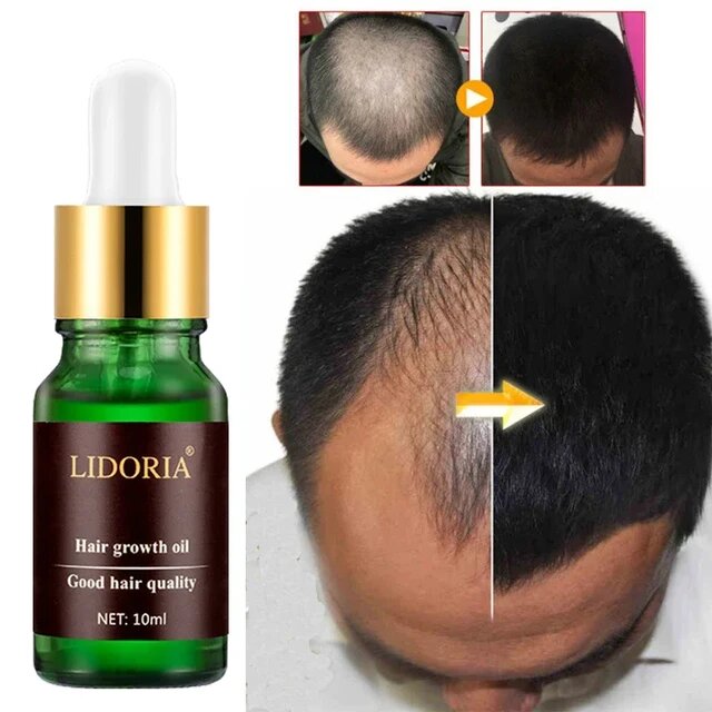 Lidoria Hair growth oil