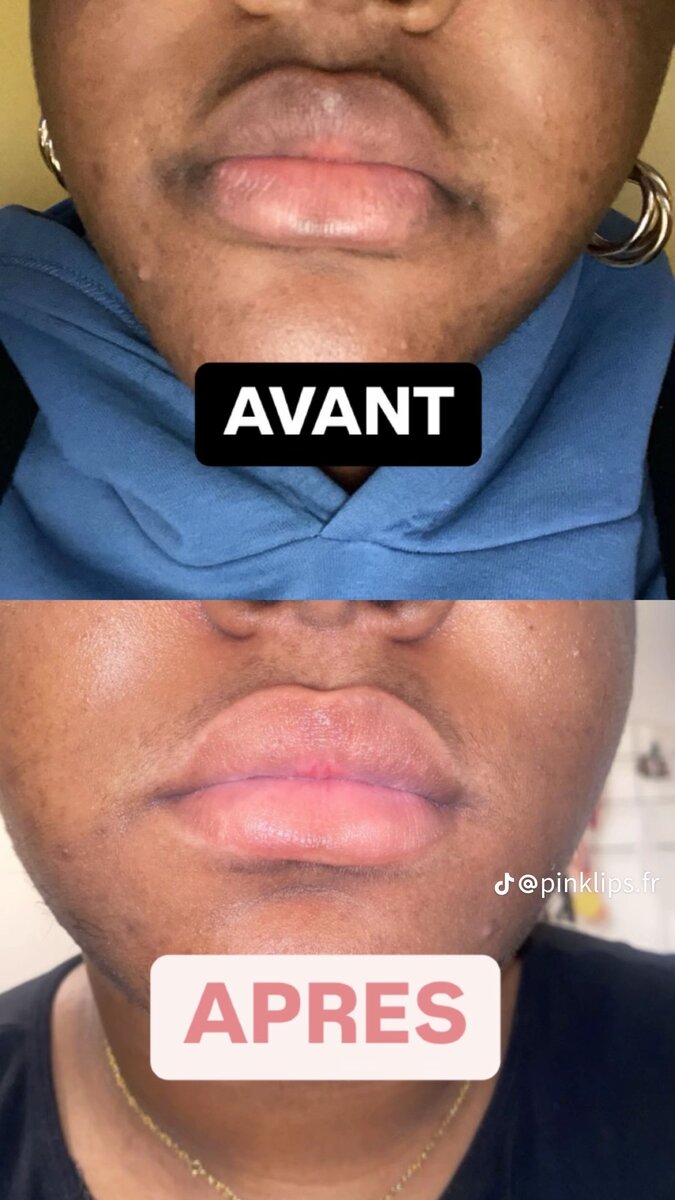 Baume à Lèvres Hydratant Rose