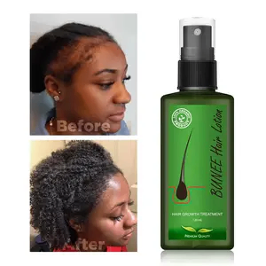 Dexe Hair Treatment