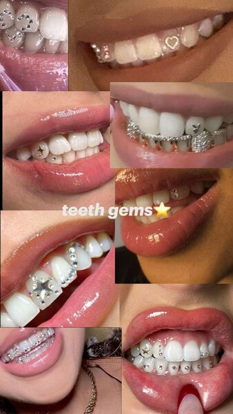 Kit de Strass Dentaire Éclatant