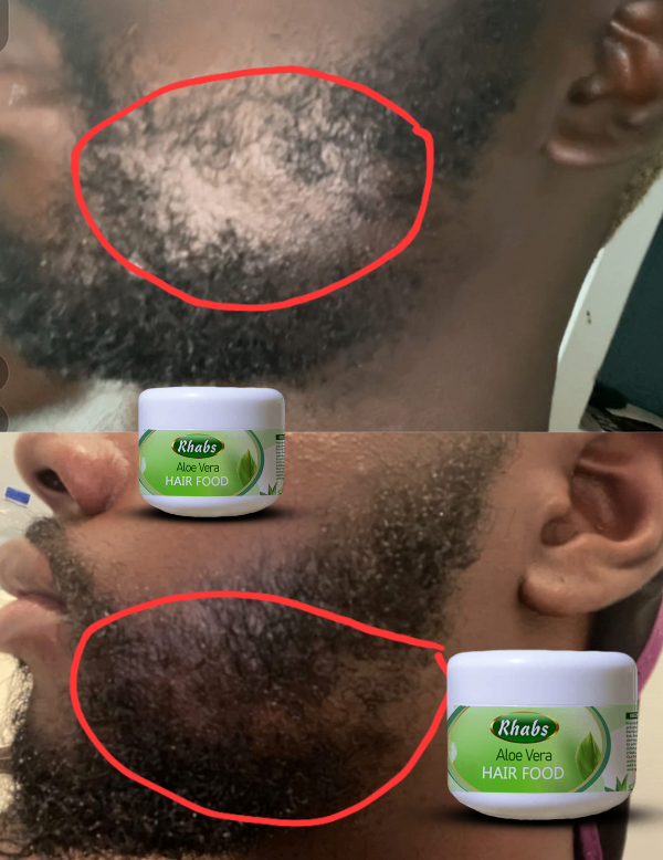 Rhabs Aloe Vera Beard & Hair Growth Food