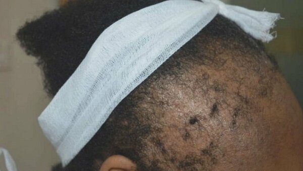 Kit Anti-Alopécie Complet