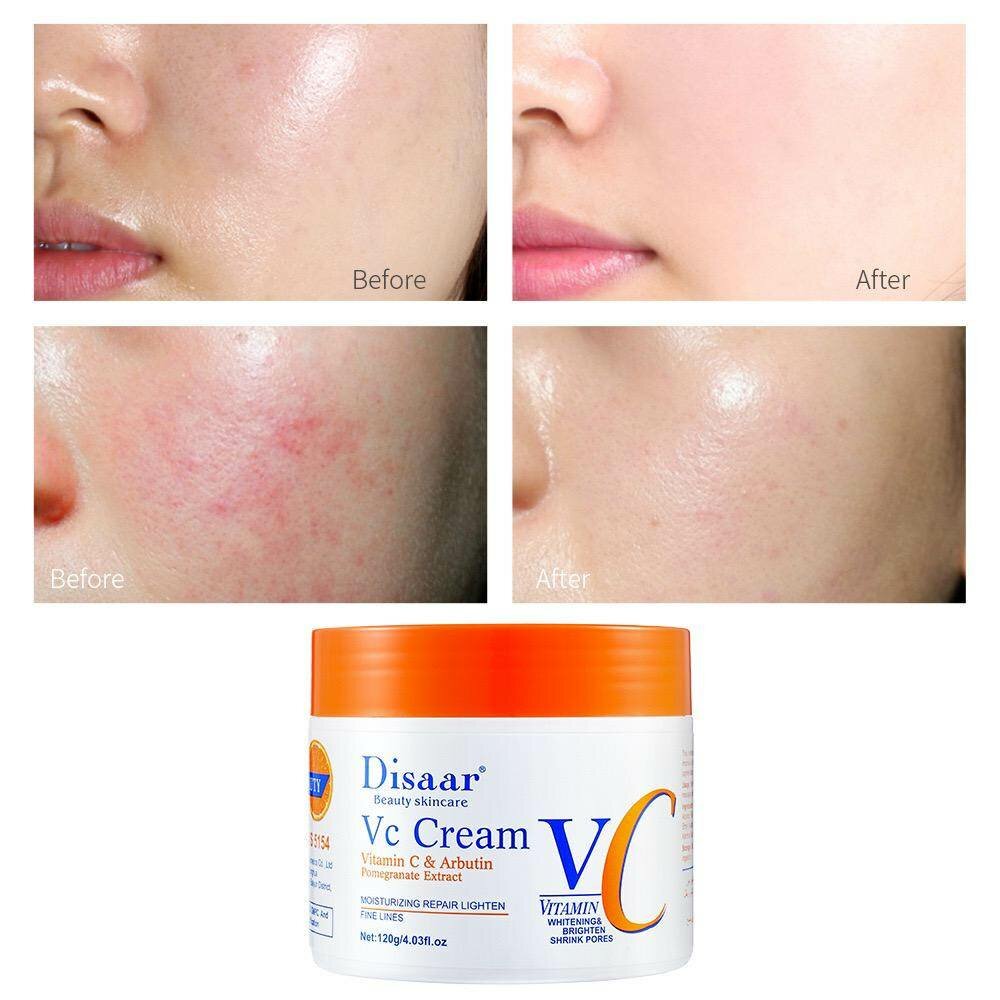 disaar vitamin c cream