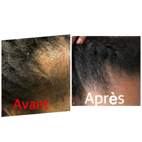 Huile Capillaire Bio