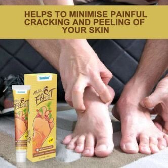 Crème antifongique pied efficace