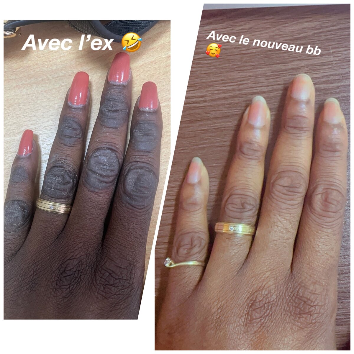 Crème anti quinto promo 5000 f au lieu de 8000