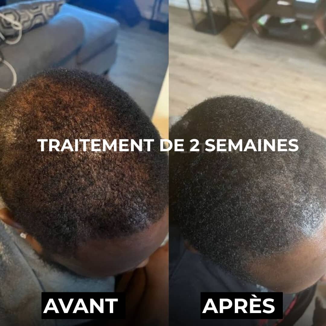 Kit Capillaire Croissance