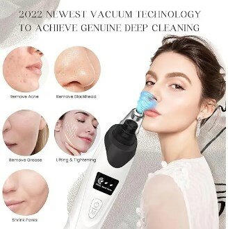 Electric Blackhead Remover