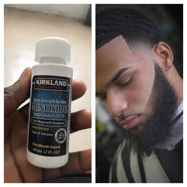 Kirkland minoxidil for beard and hair