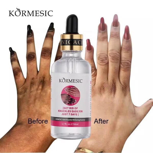 Sérum Blanchissant Anti-Âge KORMESIC