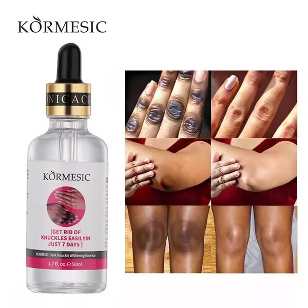 Sérum Blanchissant Anti-Âge KORMESIC