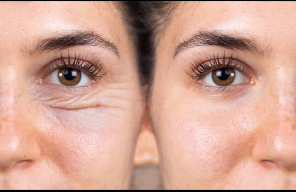 Patchs pour les yeux hydratants