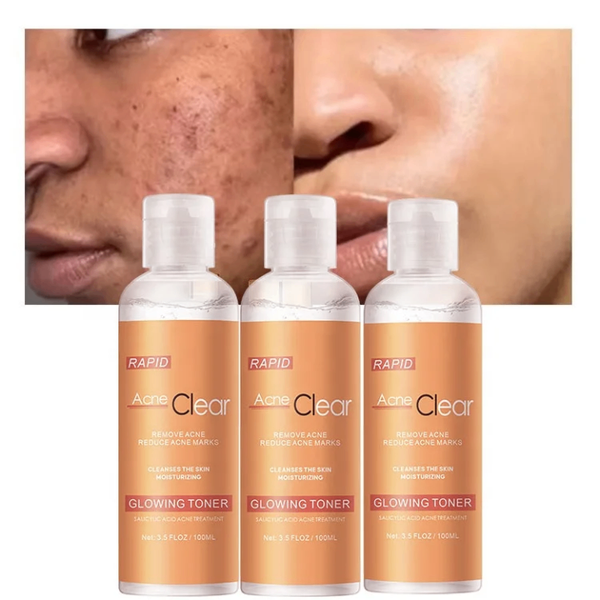 Toner Anti-Acné Rapid