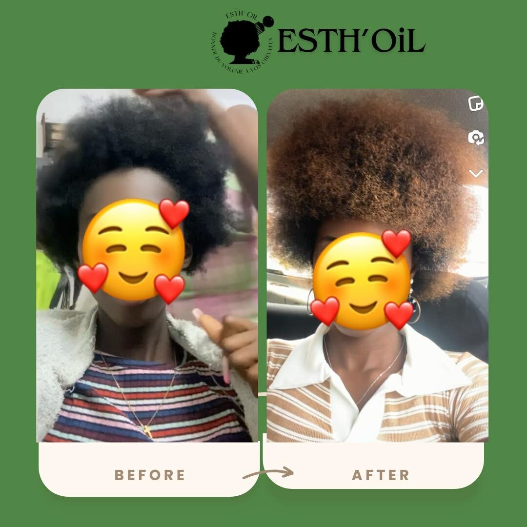 Huile Capillaire Esth'Oil