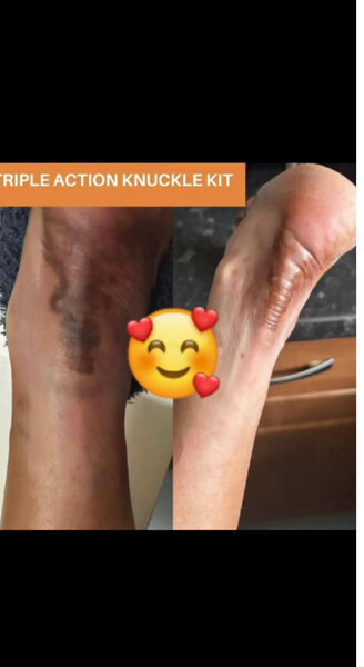 Kit Triple Action Soin Mains