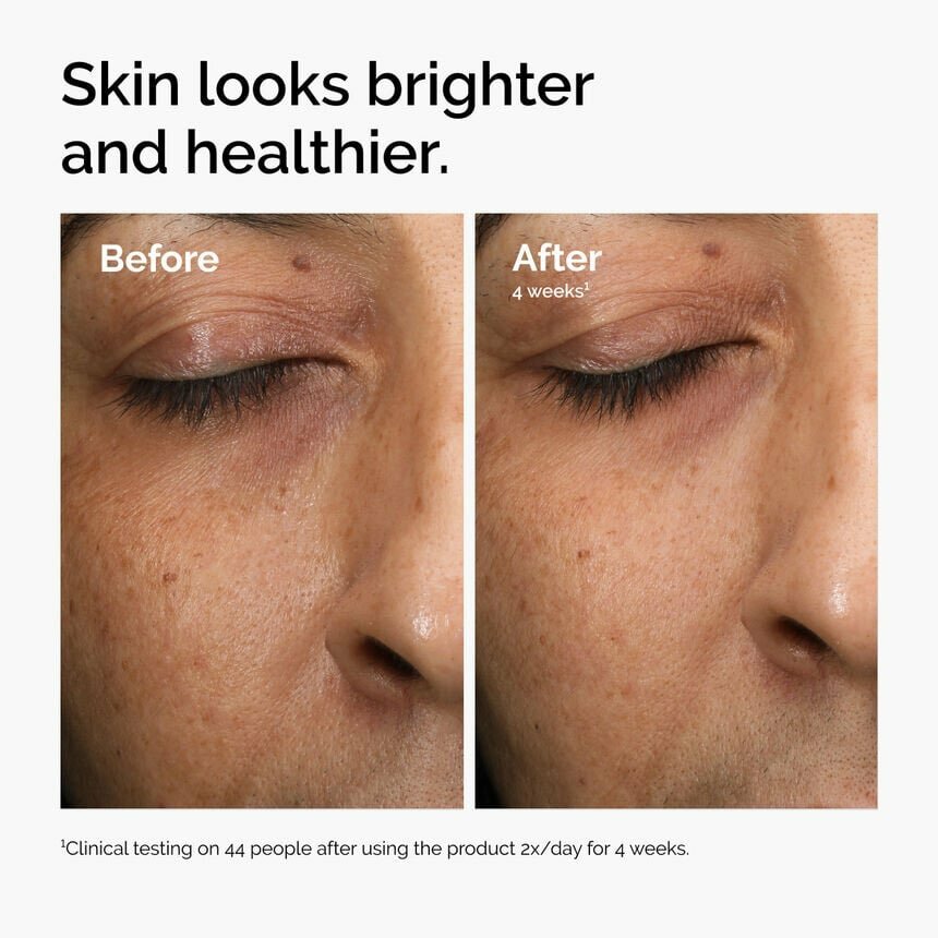 Multi Antioxydant radiance30ml