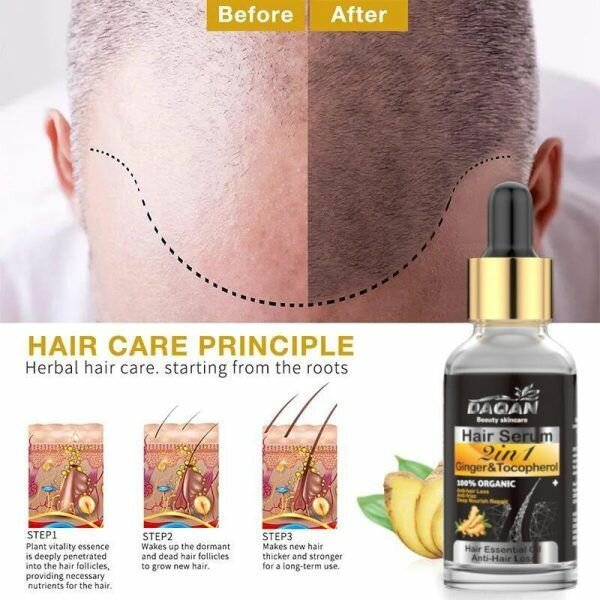 Anti hair Loss serum