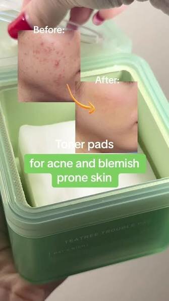 MEDIHEAL Teatree Trouble Pads