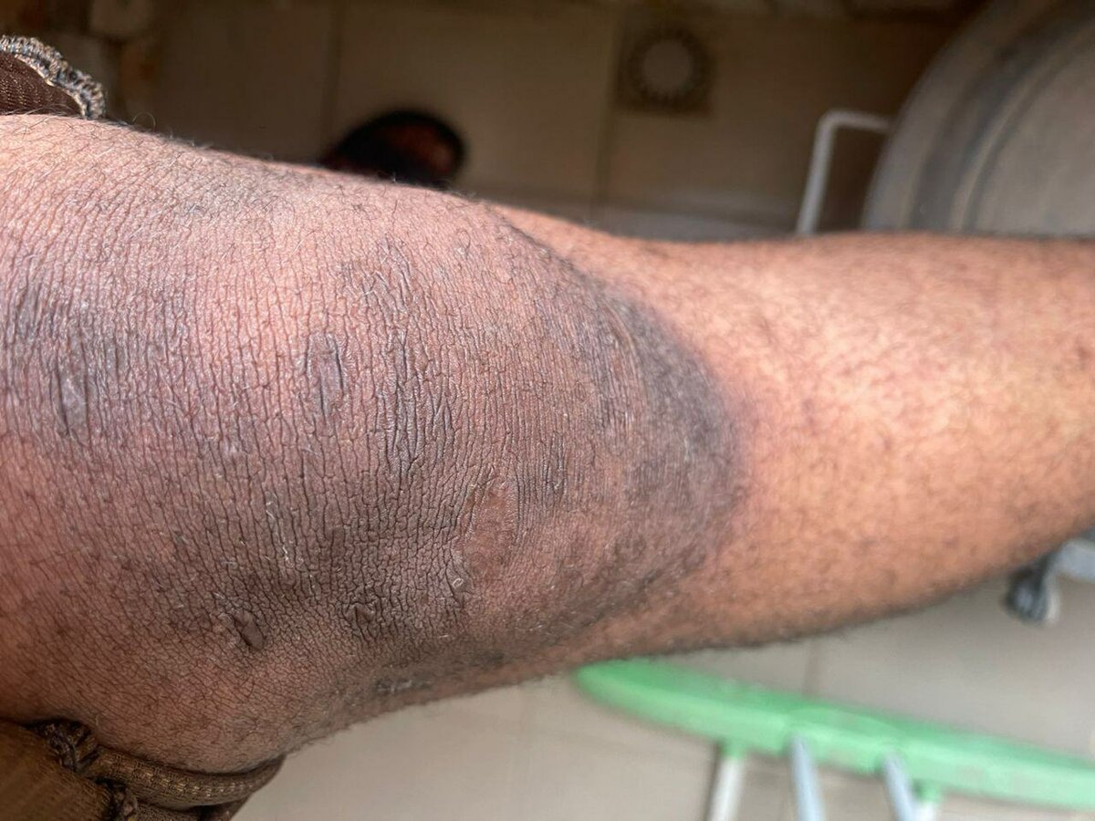 Kit Melano et lotion mami