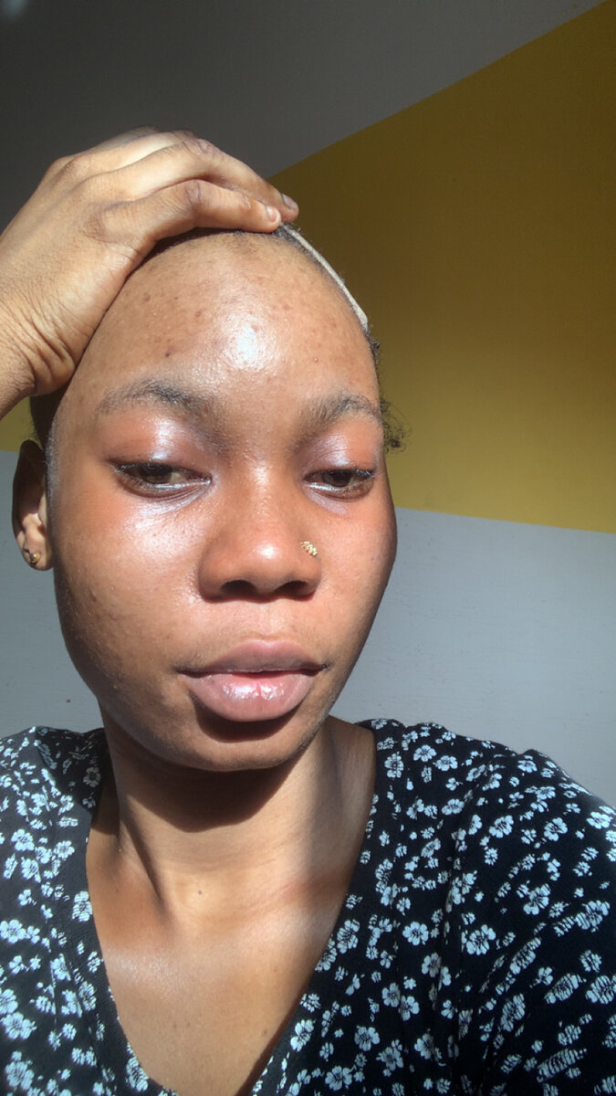 Produit pour les imperfection