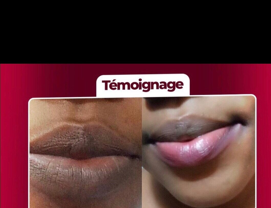 Baume Lèvres Rosé Hydratant