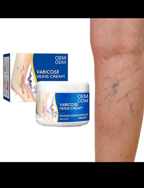 Crème Varices Soulagement