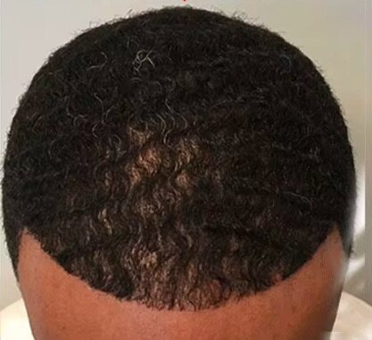 Huile de cheveux Renaissance