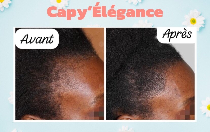 Huile Chebe Capy'Élégance Bio