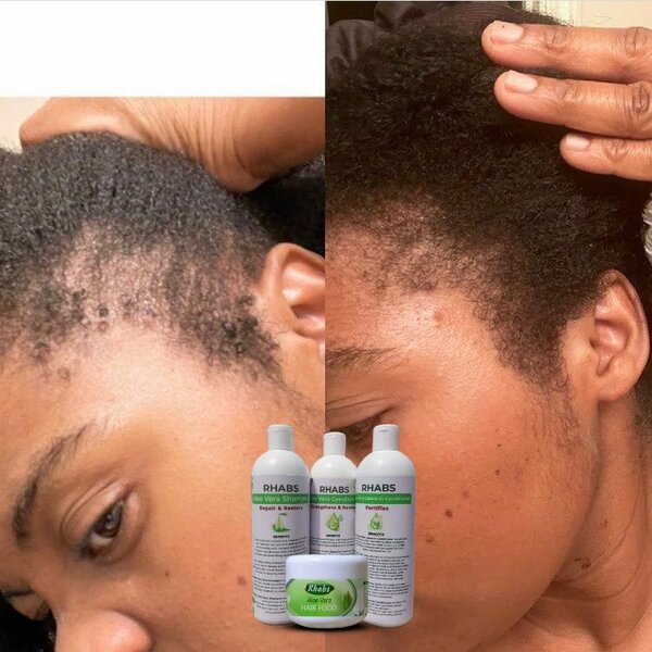 Rhabs Aloe Vera Hair Growth & Treatment Set