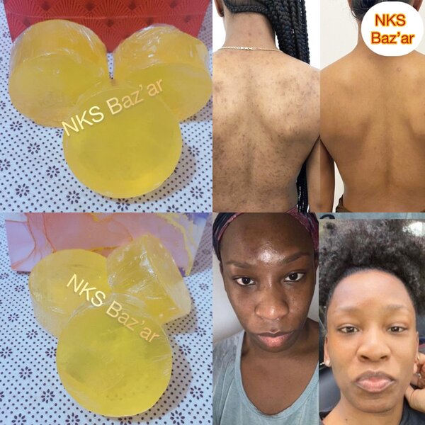 Fini délicatement le visage gras, les boutons et les taches