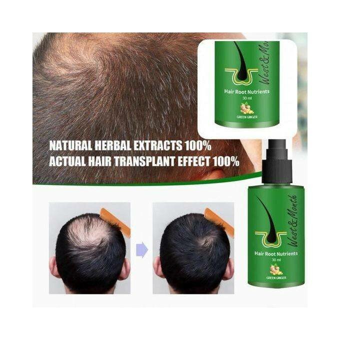 Solution de croissance des cheveux Dexe